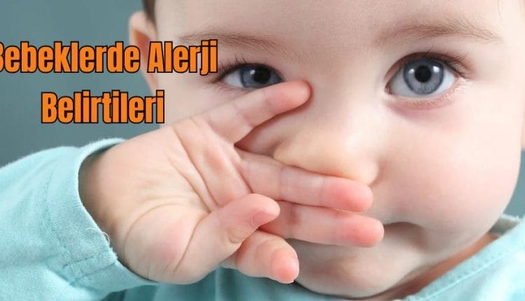 Bebeklerde Alerji Belirtileri