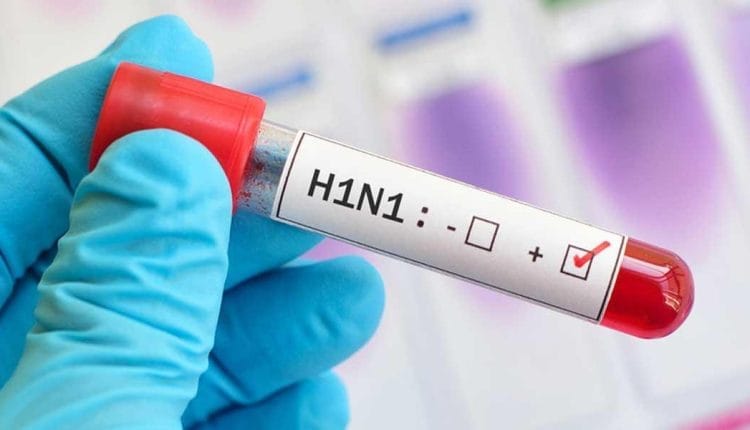 Bebeklerde Domuz Gribi Belirtileri: H1N1'in Erken Teşhisi ve Tedavi Yöntemleri 2 Bebeklerde Domuz Gribi