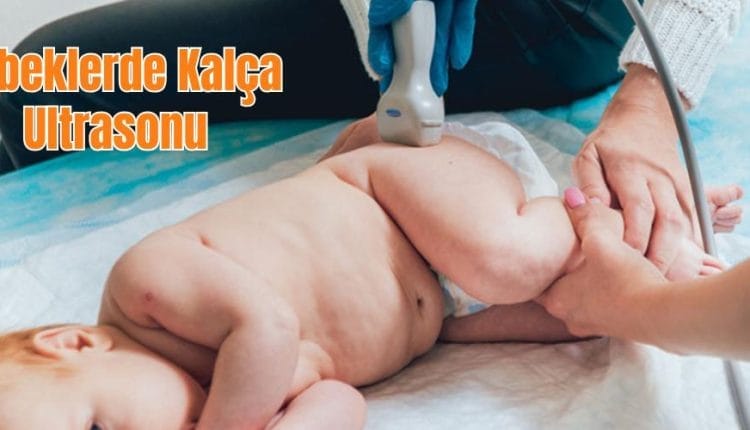Bebeklerde Kalça Ultrasonu
