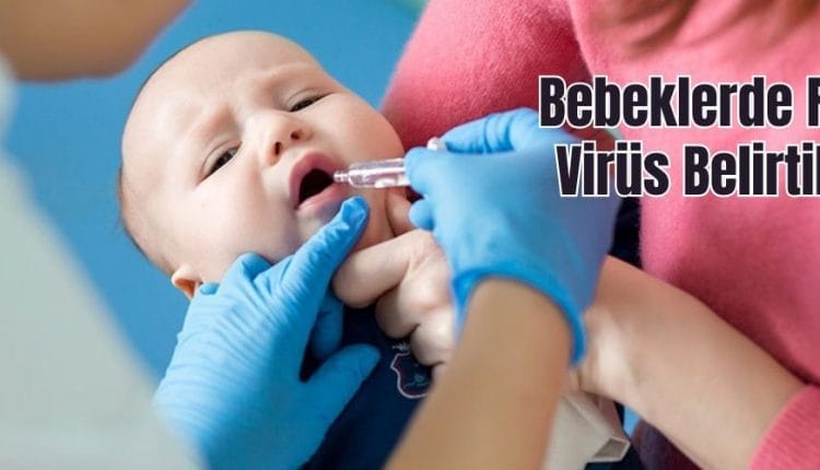 Bebeklerde Rota Virüs Belirtileri