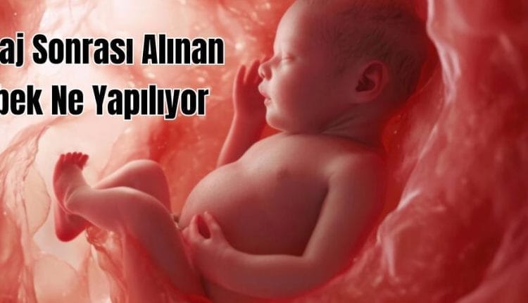 Kürtaj Sonrası Alınan Bebek Ne Yapılıyor