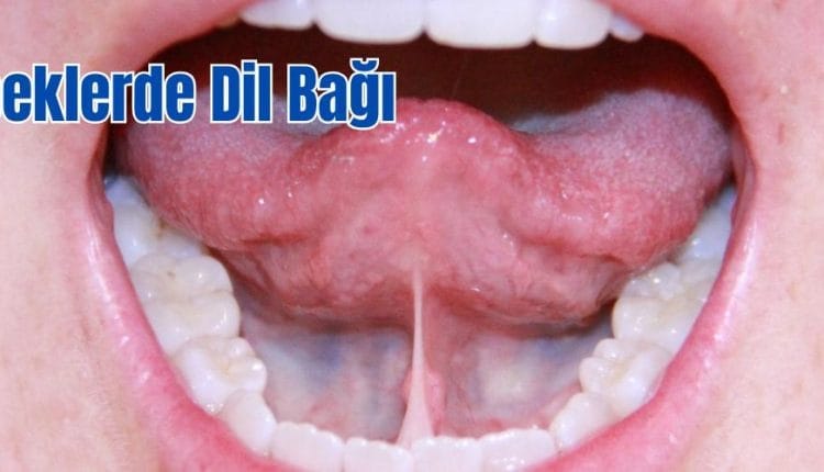 Bebeklerde Dil Bağı