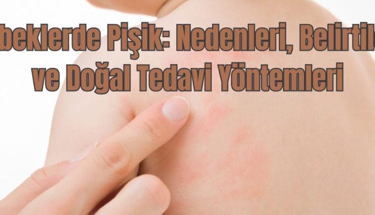 Bebeklerde Pişik Nedenleri, Belirtileri ve Doğal Tedavi Yöntemleri