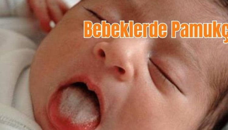 Bebeklerde Pamukçuk