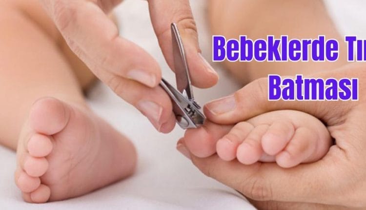 Bebeklerde Tırnak Batması