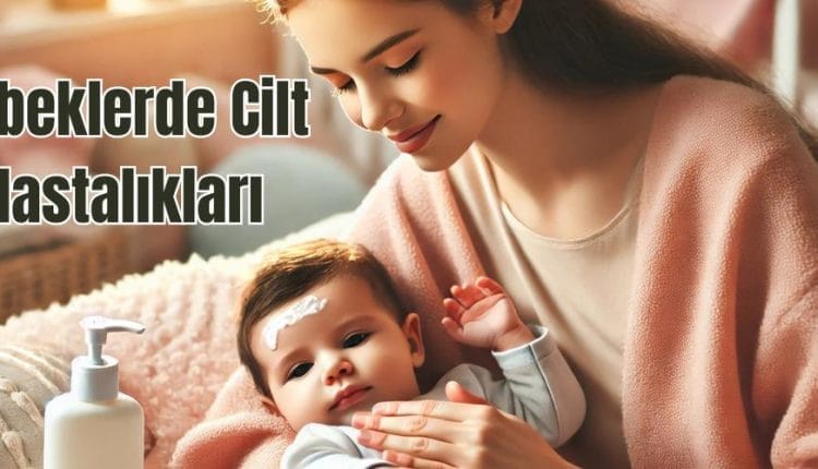 Bebeklerde Cilt Hastalıkları