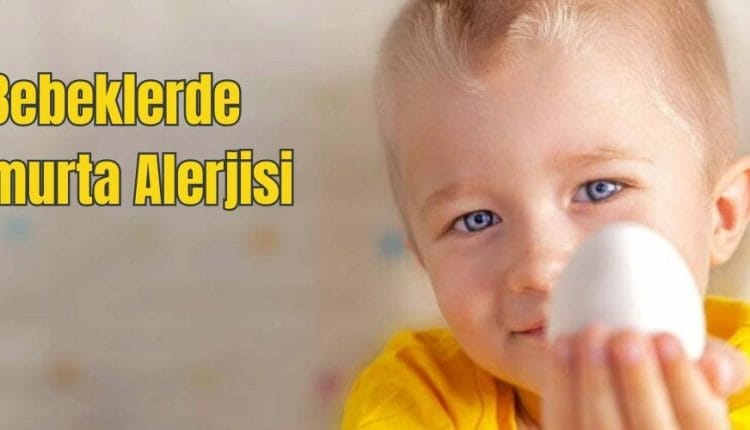 Bebeklerde Yumurta Alerjisi