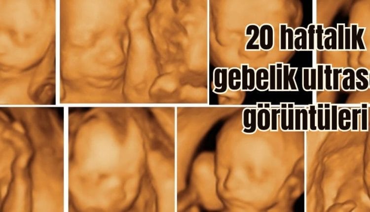 20 haftalık gebelik ultrason görüntüleri