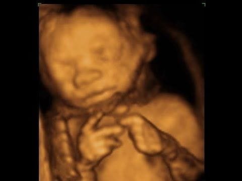 20 haftalık gebelik ultrason görüntüleri