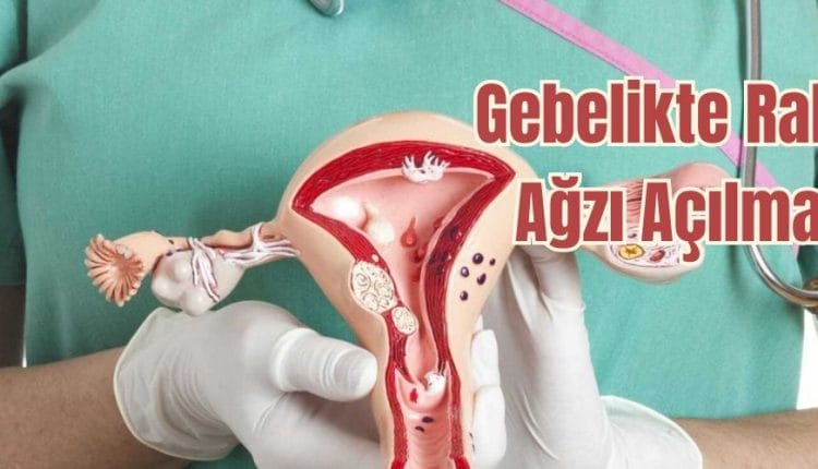 rahim ağzı açılması