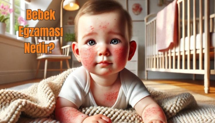 Bebek Egzaması Nedir Belirtileri, Nedenleri ve Etkili Tedavi Yöntemleri