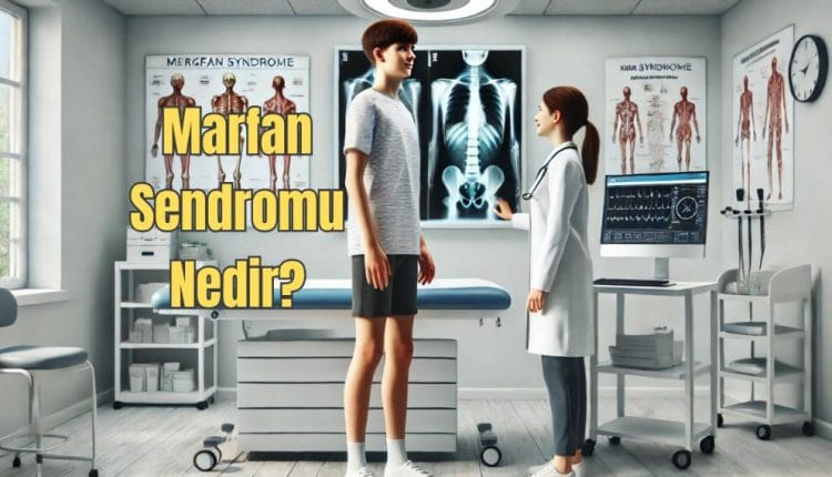 Marfan Sendromu Nedir